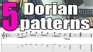 5 Dorian Jazz Guitar Licks For Beginners